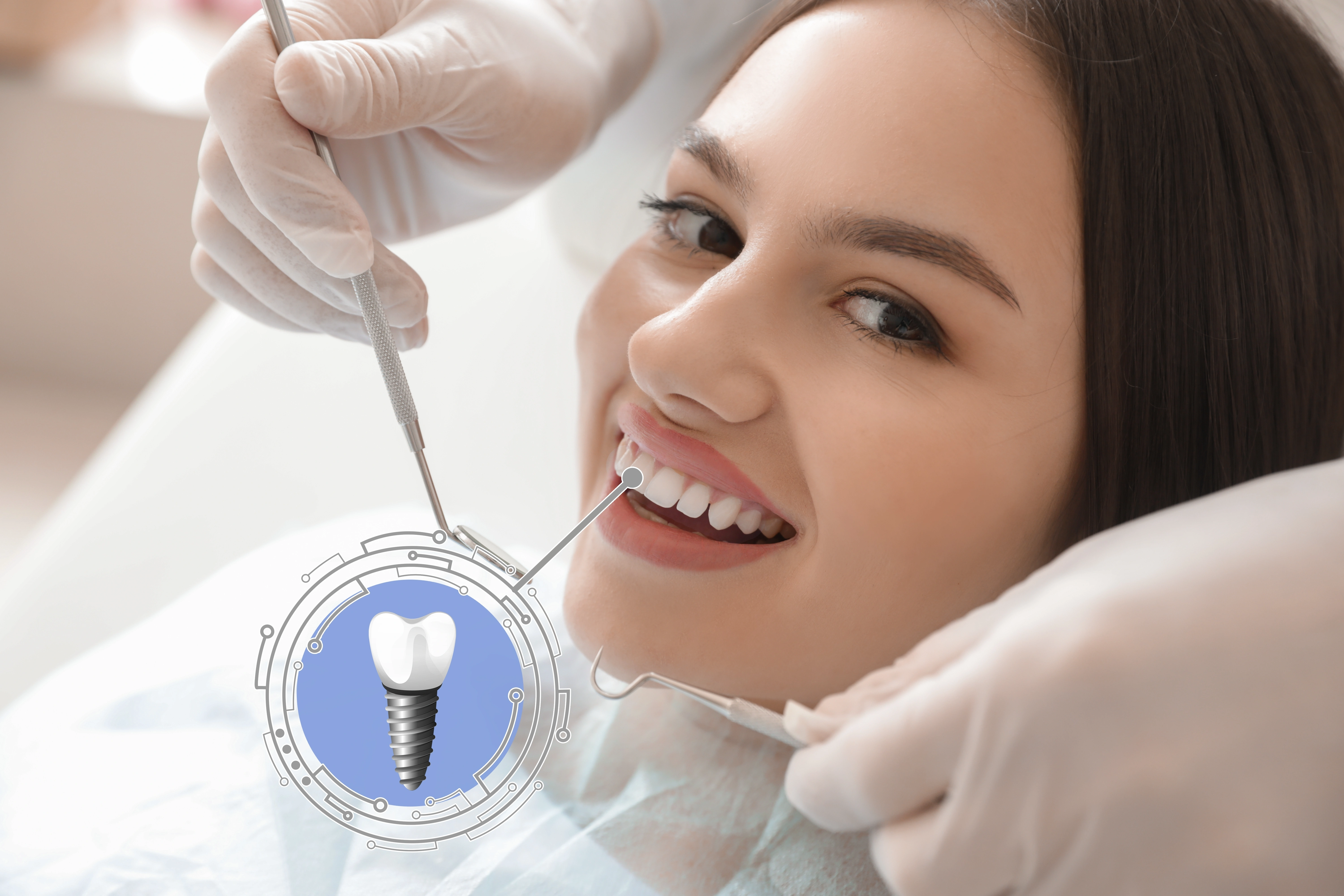 dental implant Manchester